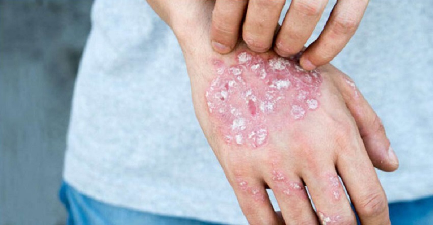 ছবি - সংগৃহীত